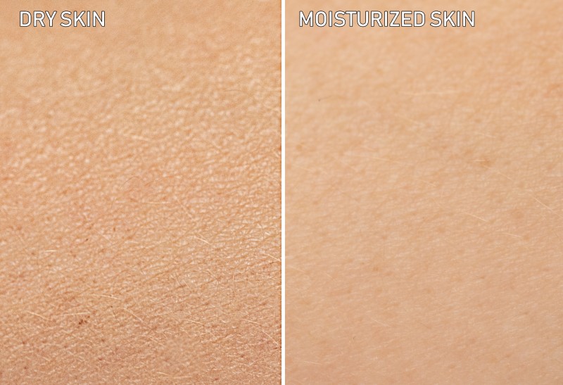 comparação entre pele seca e hidratada